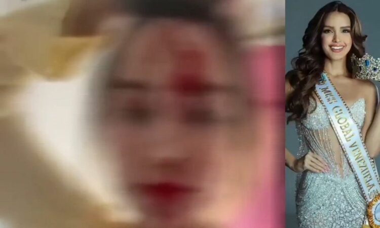 DHUNË GJATË FESTIVALIT TË KANËS, MISS VENEZUELA AKUZON STILISTIN GIOVANNI LAGUNA PËR AGRESION